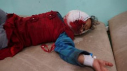  إصابة طفلة بقصف صاروخي سعودي على صعدة 20 01 2020